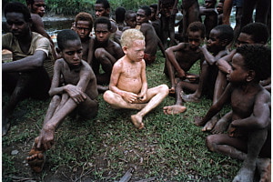 Albino