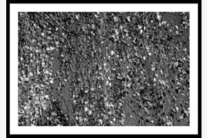 Abstract 