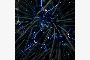 Seeigel