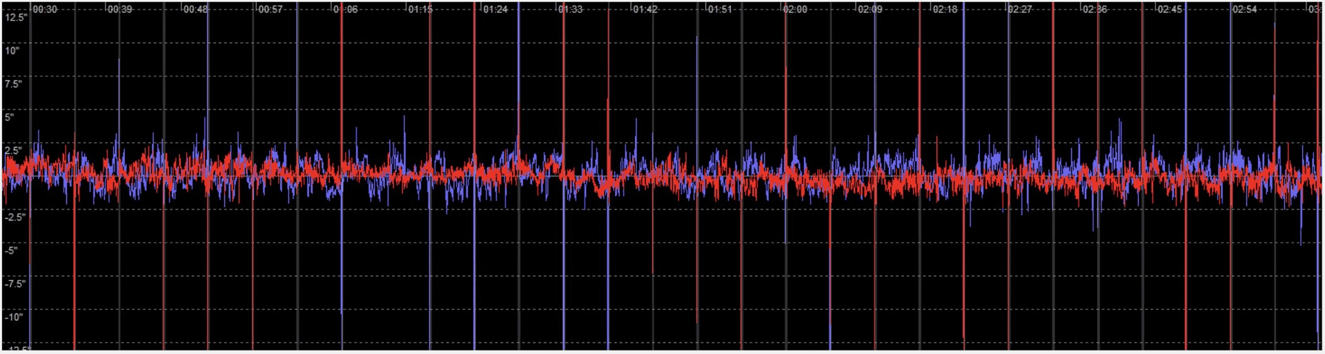 Guiding-Plot der EmCanAstro EM31 Pro mit Dithering-Spitzen